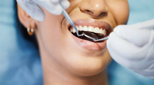 Best Emergency Treatment for Oral Infections in Crandall, TX