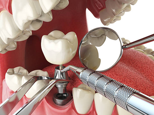 Best Walk-In Emergency Dental Services in Crandall, TX